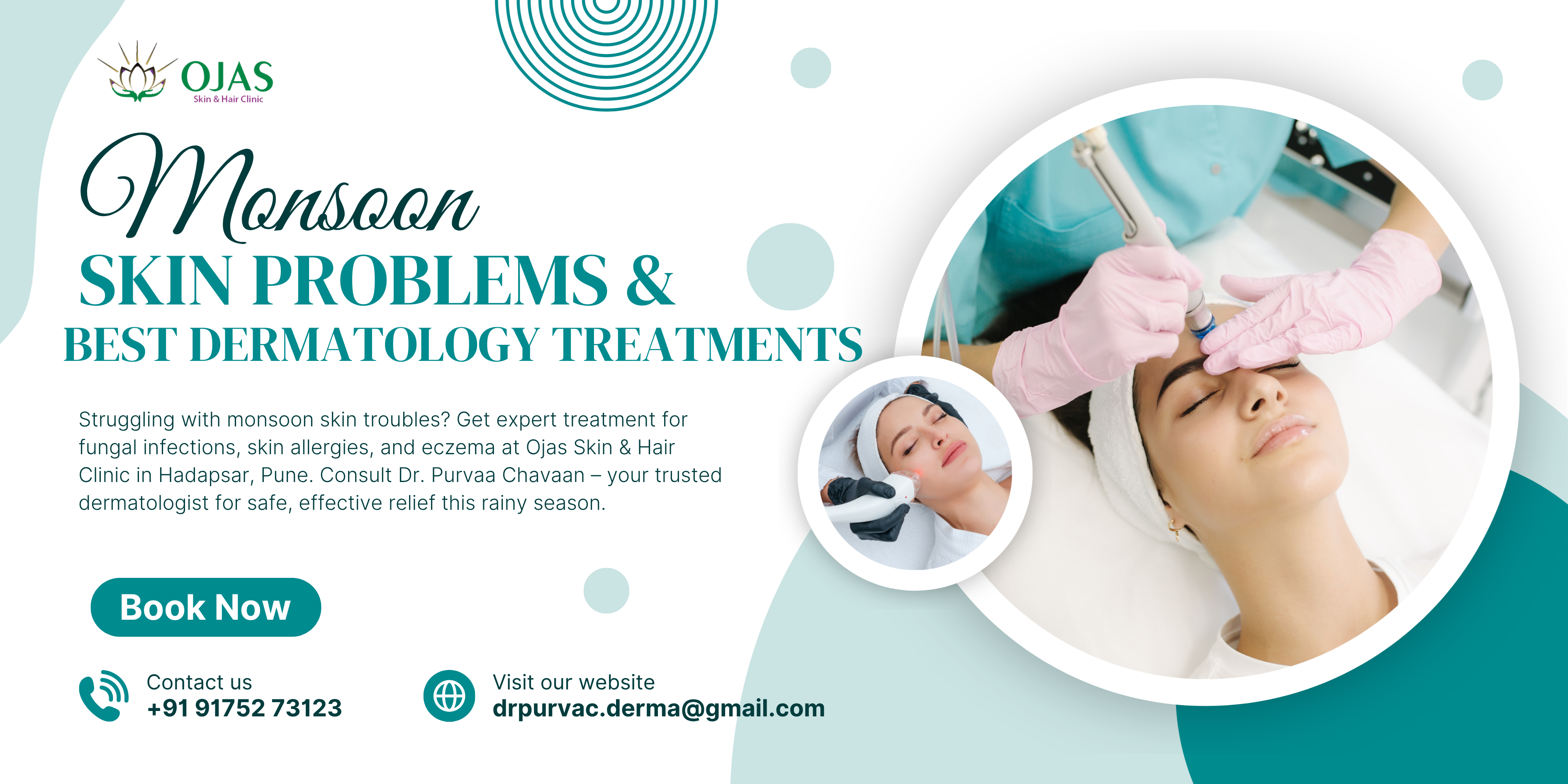 monsoon-skin-problems-treatment