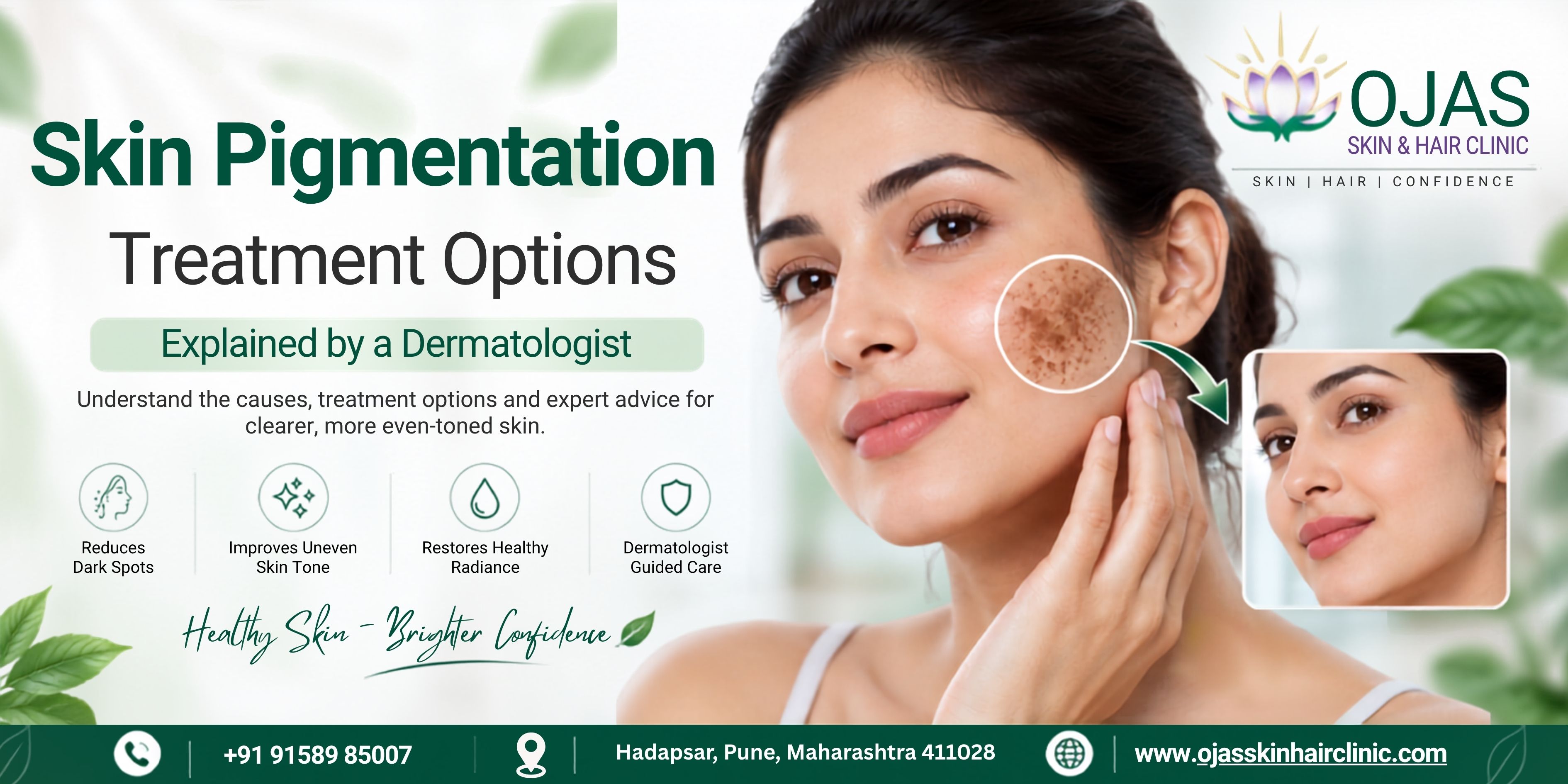 Skincare products and sunscreen recommended for pigmentation treatment