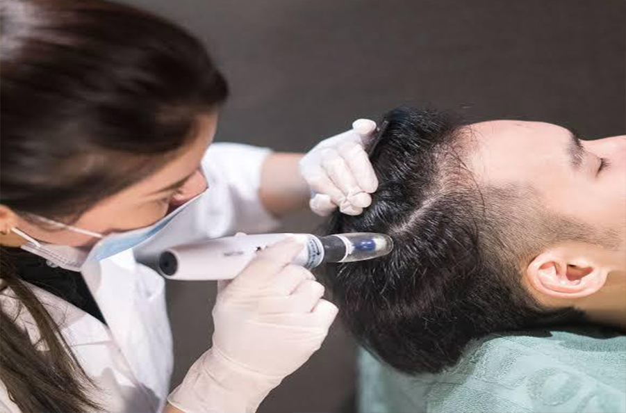 Hair Mesotherapy