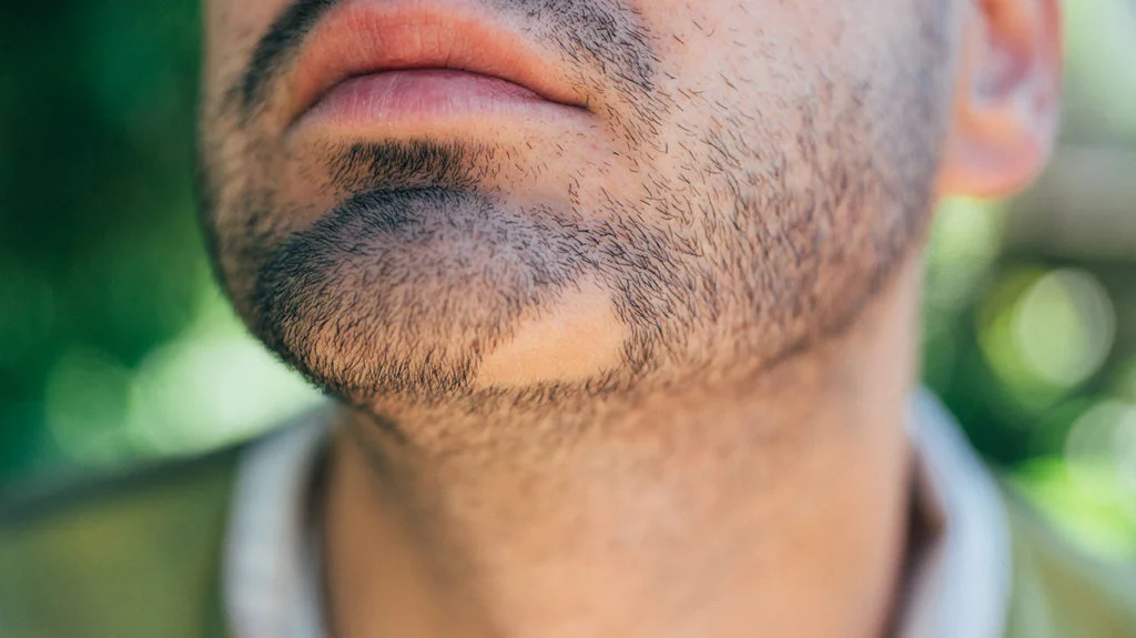 Alopecia therapy