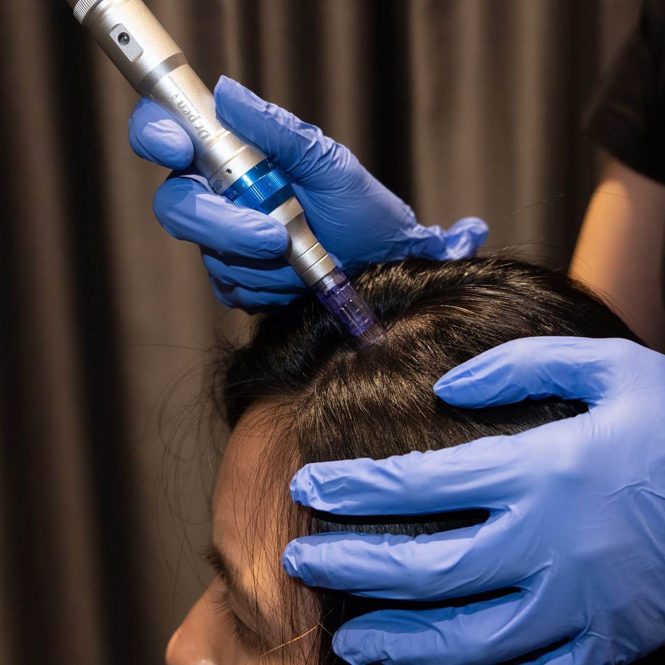 Derma Pen Treatment